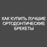 Как купить лучшие ортодонтические брекеты